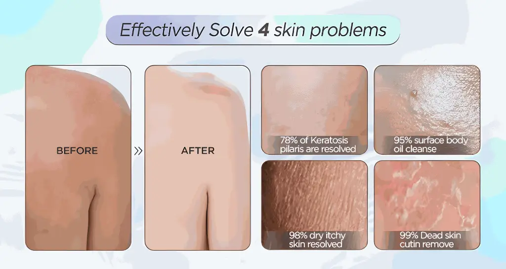 Screenshot 2024-09-21 at 16-44-32 Laotang Korean 100% Viscose Moroccan Exfoliating Gloves Mitt Shower Exfoliator For Home Use - Buy Exfoliating Bath Gloves moroccan Exfoliating Gloves scrub Gloves Exfolaiting Product on Alibaba.com.webp